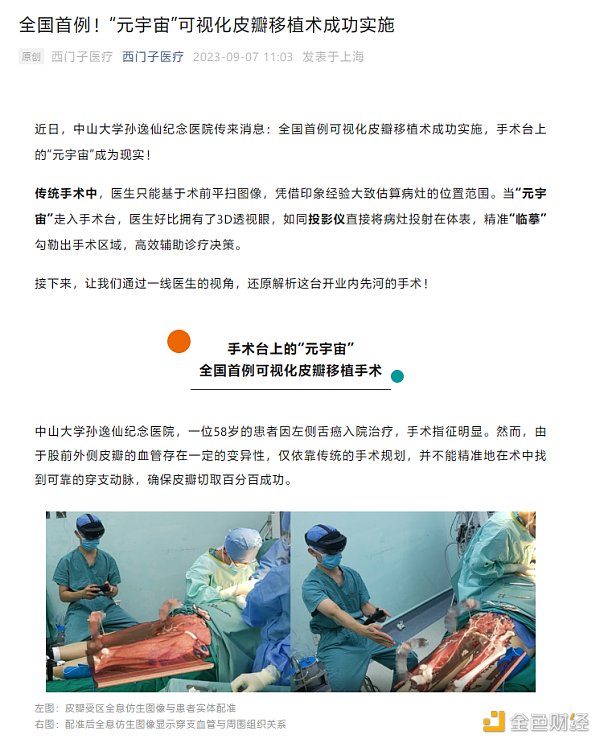 全国首例  “元宇宙”可视化皮瓣移植术成功实施  医生像开了透视眼